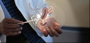 Cáncer de cuello uterino: por primera vez un país se encamina a eliminarlo