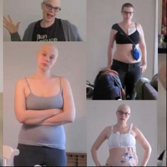 Video impactante: un año con cáncer de mama, en un minuto