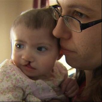 Madre subrogante se niega a abortar a un bebé al que le encontraron una malformación durante el embarazo