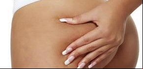 La celulitis, ¿tiene solución?