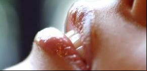 Rejuvenecimiento labial