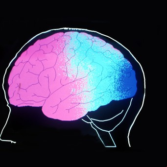 ¿Qué son el glioma y el cáncer de cerebro? 