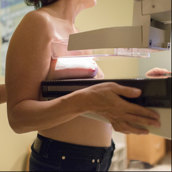 Telemamografías, para tener el resultado sin demora