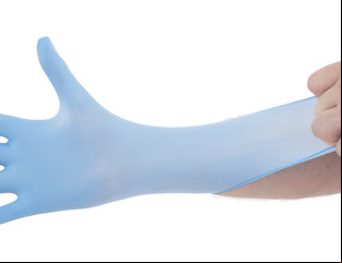 Chequeos que previenen el cáncer de cuello de útero