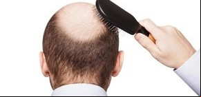¿Encontraron la cura para la pérdida de pelo?