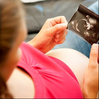 El embarazo adolescente bajó 20% en los últimos tres años