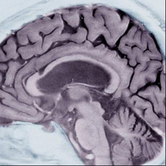 Logran la detección temprana del Alzheimer con pruebas de escritura