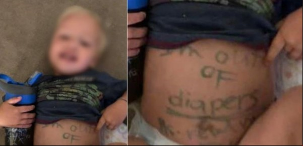 Recibe un mensaje escrito con marcador en la panza de su hijo y estalla de furia contra la guardería