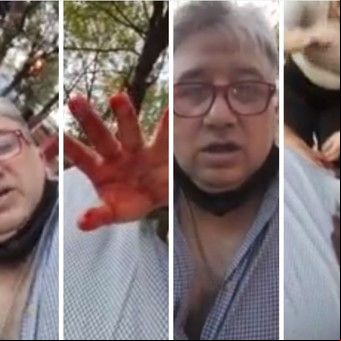 La desesperación del periodista que grabó un video mientras se desangraba: "Estuve a segundos de morir "