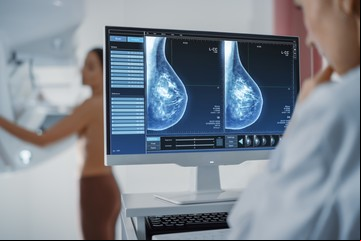 Cáncer de mama: avances en tratamientos, cuándo iniciar controles y ¿autoexamen sí o no?