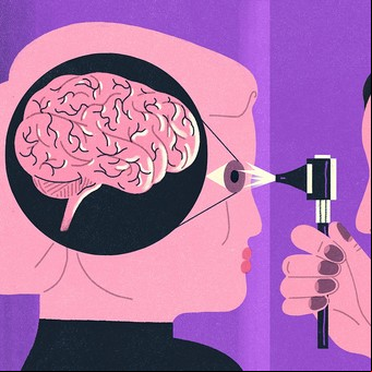 La pérdida de la visión puede afectar al cerebro