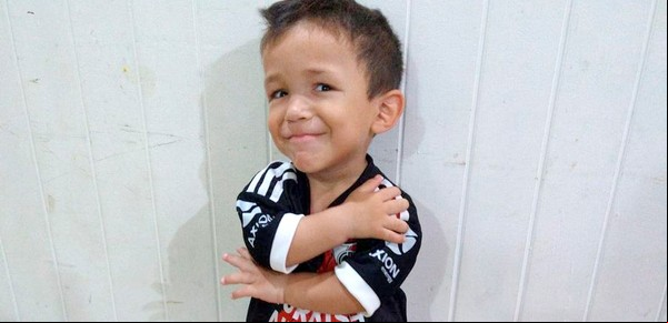 La ANMAT autorizó en el país una droga contra el enanismo y se abre una esperanza para muchas familias