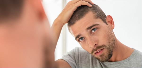 Cuáles son las vitaminas que hay que tomar para evitar la caída del pelo