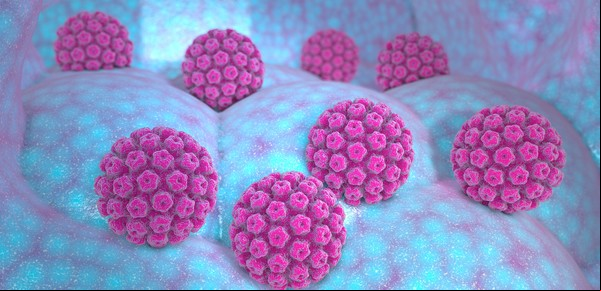 VPH, un virus muy común que produce varios tipos de cáncer: la buena, la mala y la oportunidad