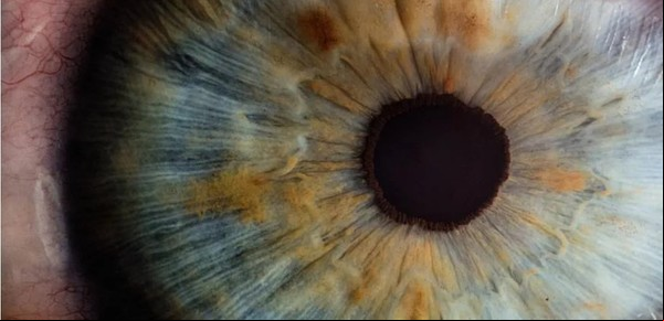 Logran restaurar un destello de vida en los ojos de un muerto