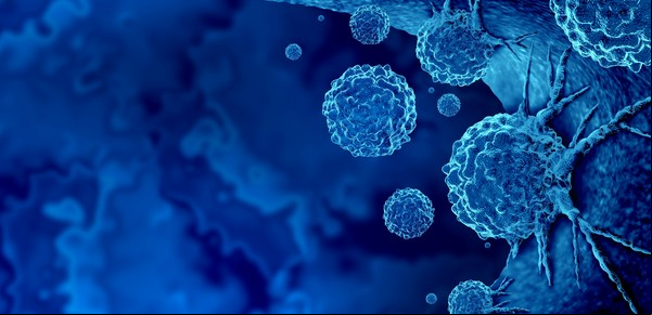 La transformación del cáncer: los avances de la ciencia y el desafío de volverlo enfermedad crónica