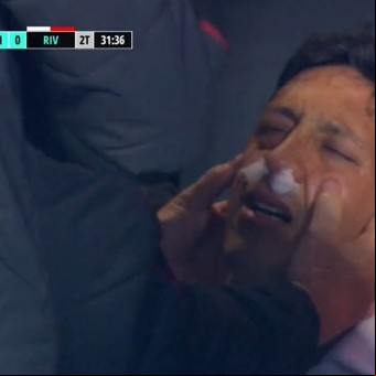 Aliendro, fracturado y con la cara como un boxeador noqueado: qué le pasó al jugador de River en una jugada que no se repitió