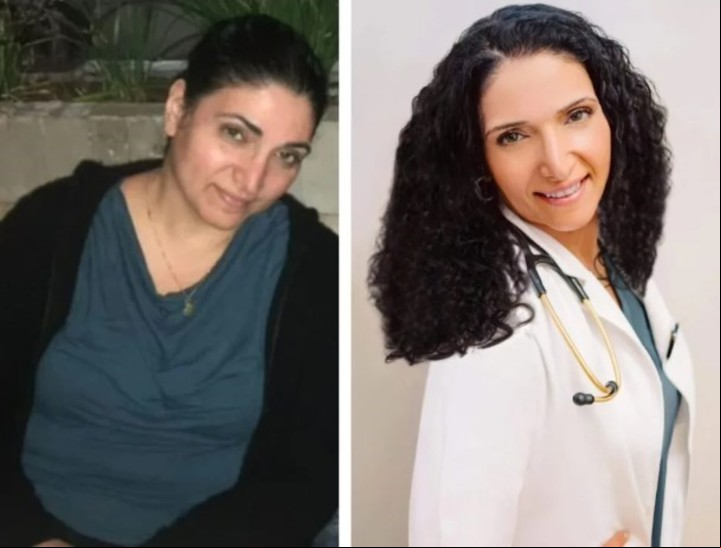 Antes y después de la médica Emi Hosoda, quien ayuda a pacientes a partir de su experiencia tras bajar 45 kilos.