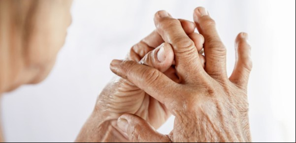 ¿Qué partes del cuerpo afecta la artritis reumatoide?