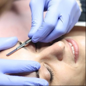 Dermaplaning: ¿es realmente efectivo o un riesgo para la piel?