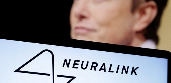 Neuralink: reportan las primeras fallas del chip implantado a un cerebro humano