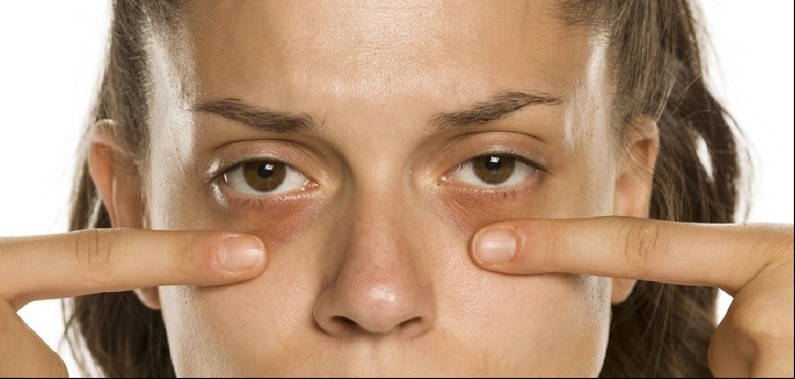 Ojeras envejecimiento rostro problemas en la piel