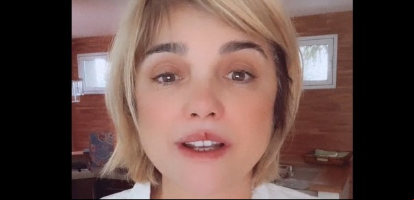 Araceli González contó que le diagnosticaron SIBO: "Lo tomé con mucha calma"