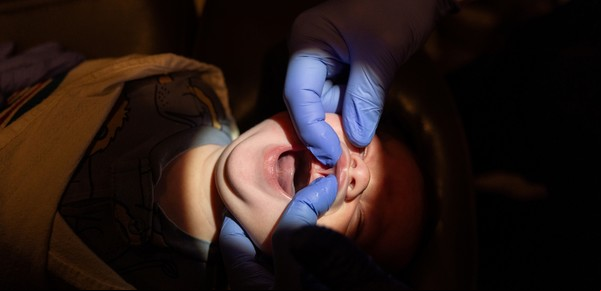 El floreciente negocio de cortar la lengua de los bebés