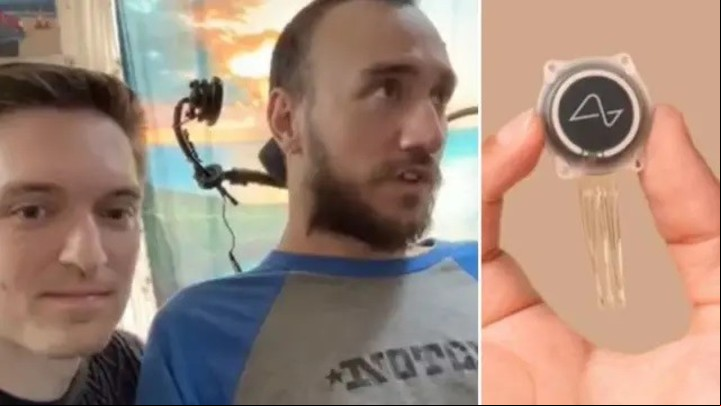 El primer paciente con el chip cerebral de Neuralink. Foto: Neuralink