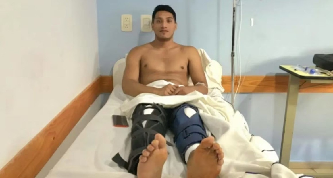 La Plata: un joven denunció que fue a hacerse una cirugía de una rodilla, pero le operaron las dos
