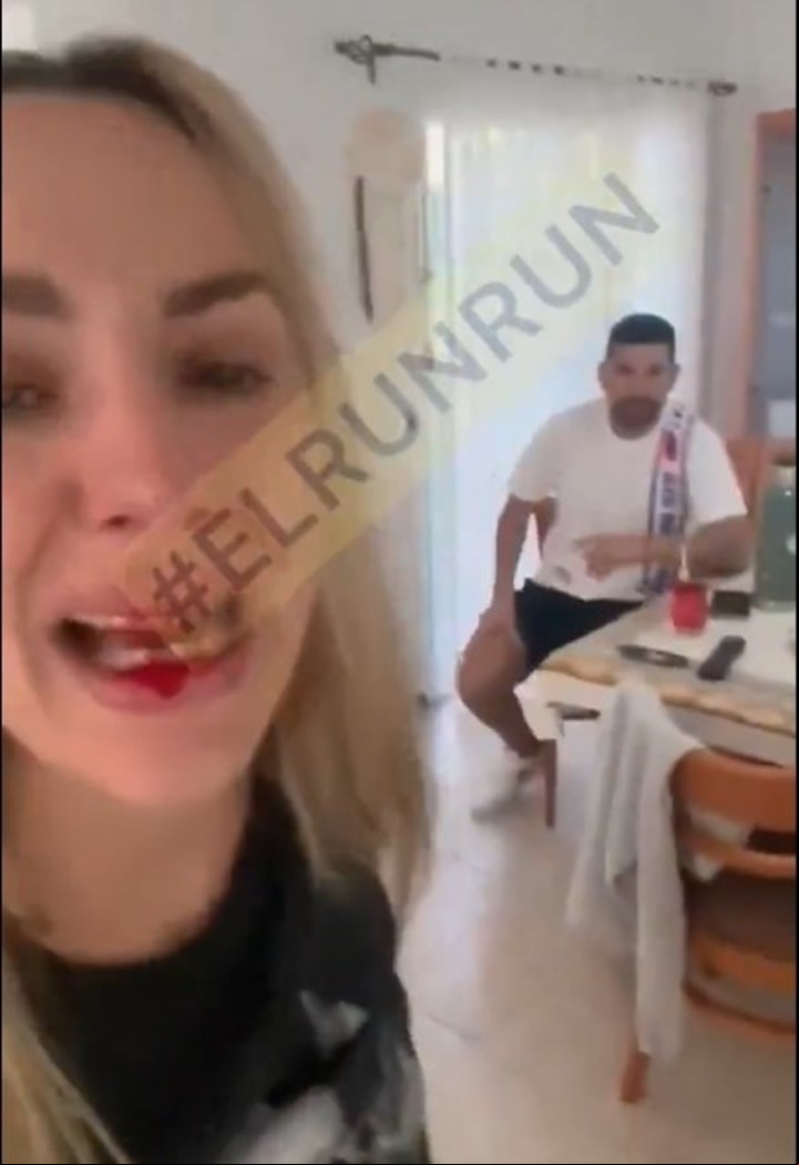 El video en el que la pareja de Néstor Ortigoza se muestra con la boca ensangrentada.