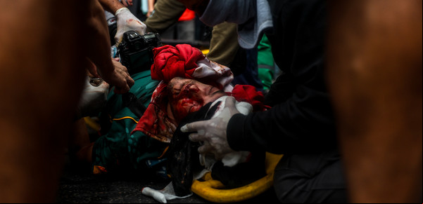 El padre de Pablo Grillo dio un dato esperanzador sobre el estado de salud del fotógrafo herido de gravedad en los disturbios frente al Congreso