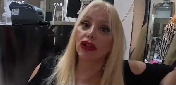 "Volé por el aire", el duro relato de Flavia Miller tras ser atropellada por un auto