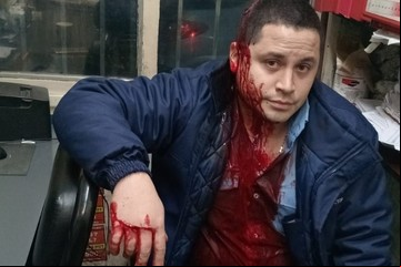 Apuñalaron a un colectivero en un violento robo en La Matanza: hay paro en la línea 126 en reclamo de seguridad