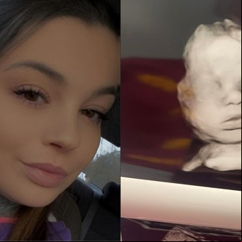 Una madre aseguró ver "la mano de Dios" en la ecografía de su bebé